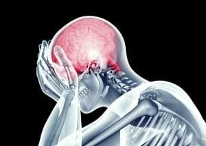 Headaches-300x213