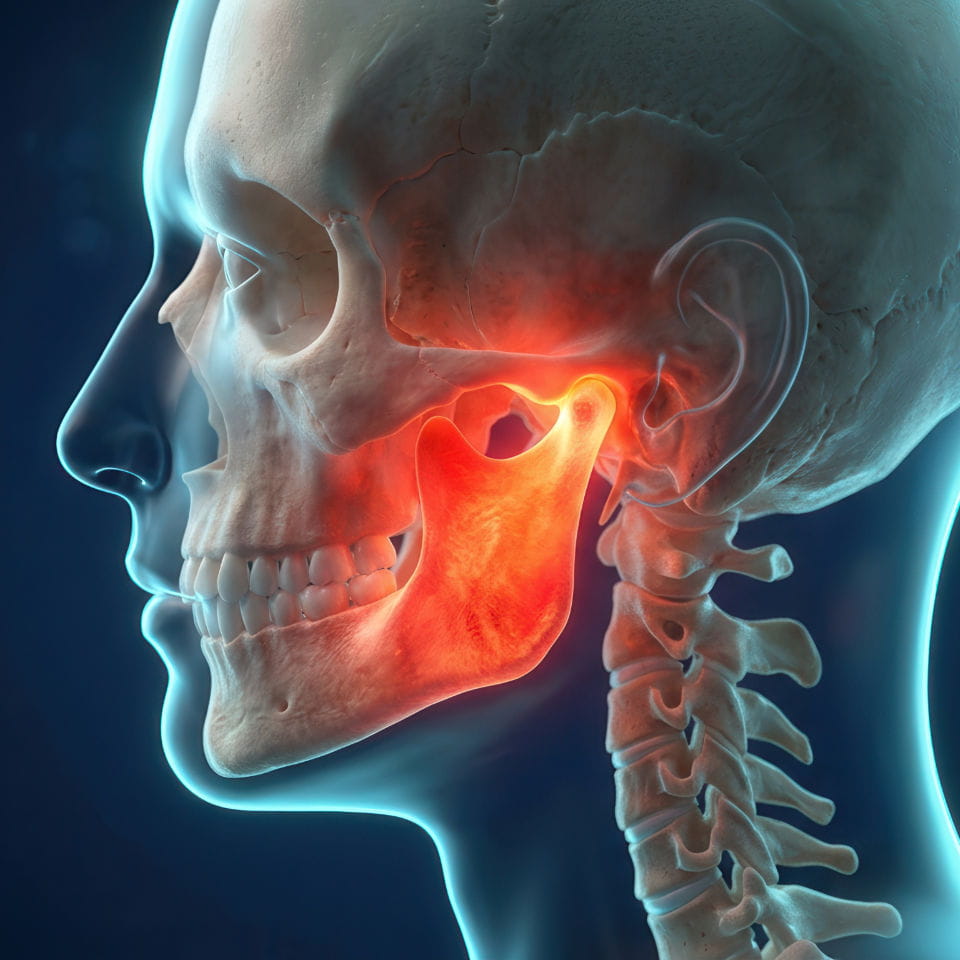 TMJ & Jaw Pain